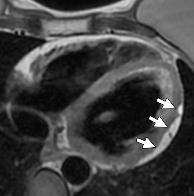 Figure 4a: