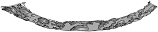 graphic file with name z7g9990908440011.jpg