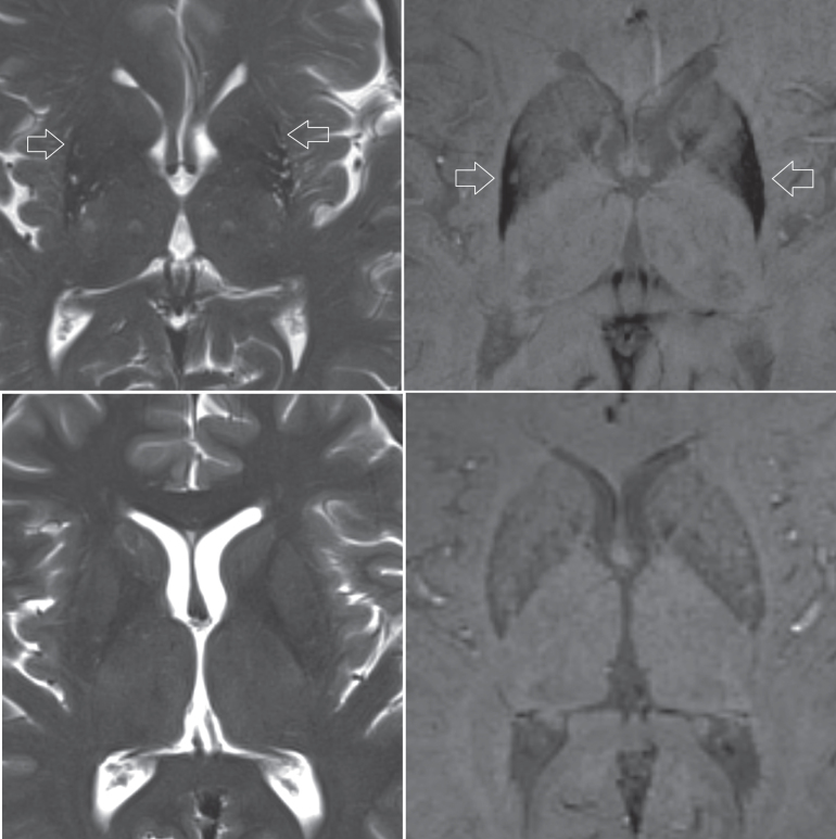 Fig.1