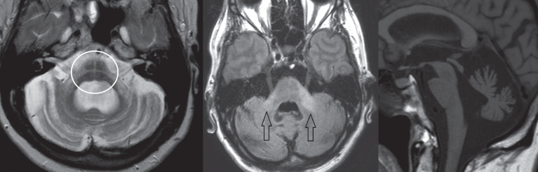 Fig.2