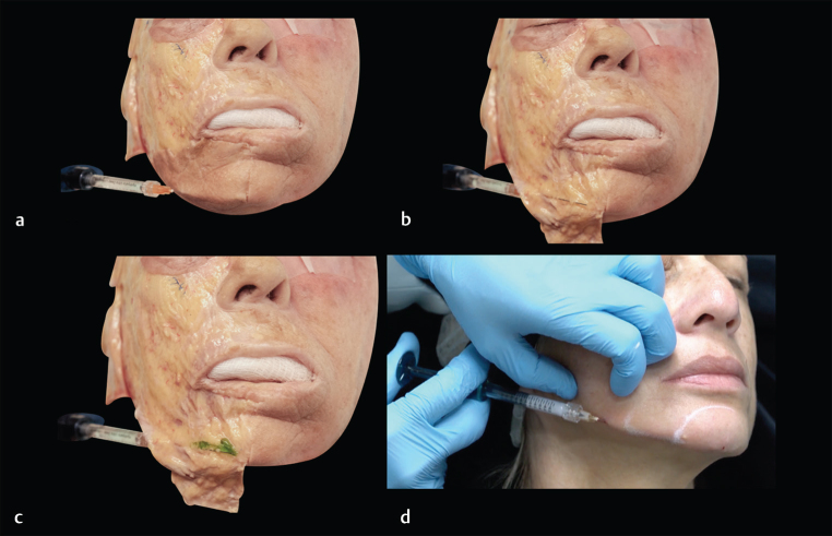 Fig. 13﻿