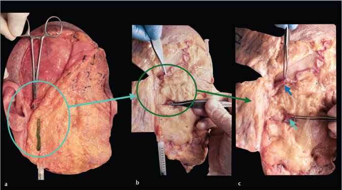 Fig. 17﻿