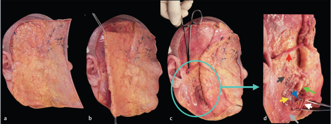 Fig. 2﻿