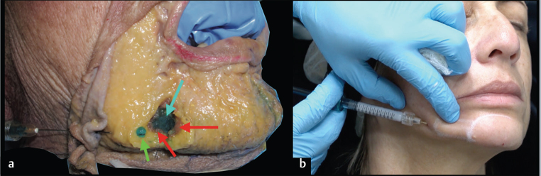 Fig. 14﻿