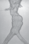 Figure 21b.