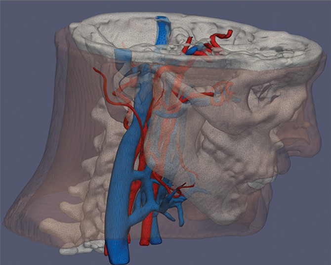 Figure 1b.