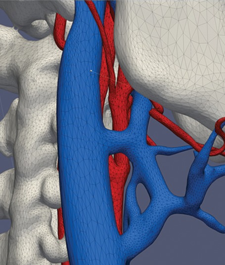 Figure 1c.