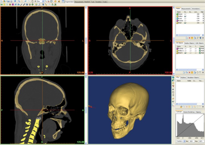 Figure 4a.