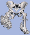 Figures 17a.