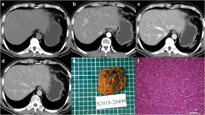 Fig. 4