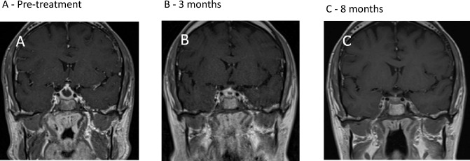 Fig. 3