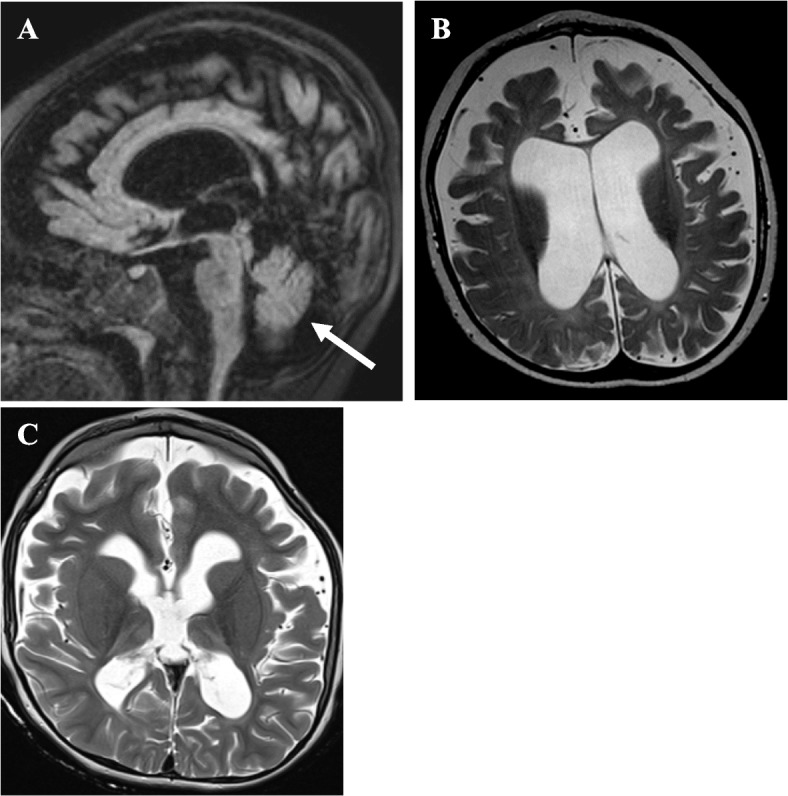 Fig. 1