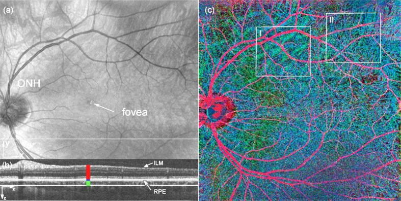 Fig. 19