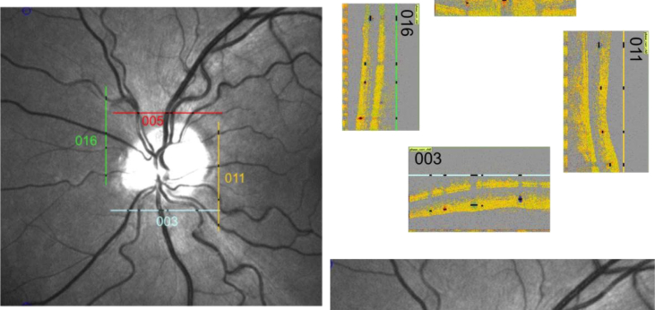 Fig. 16