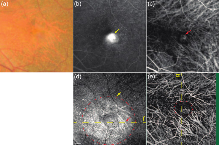 Fig. 23