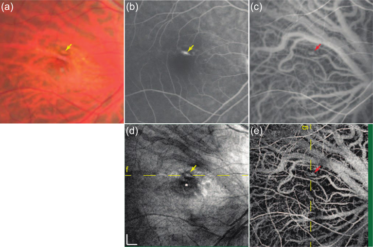 Fig. 22