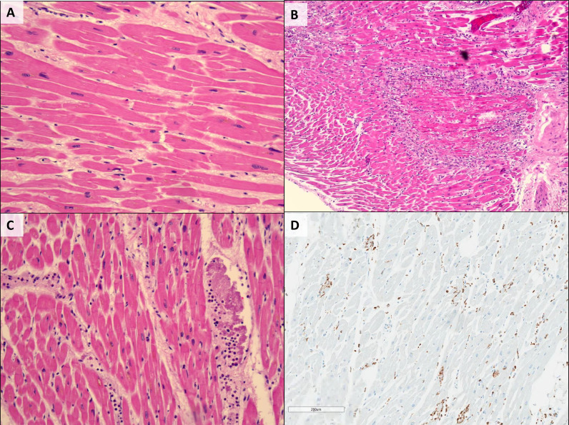 Fig 1: