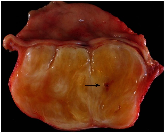 Fig. 3