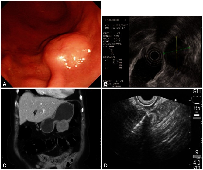 Fig. 1