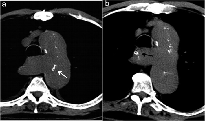 Figure 6a–b.