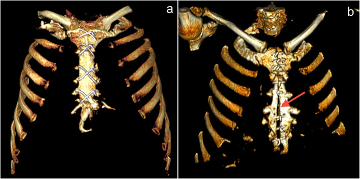 Figure 1a–b.