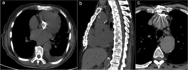 Figure 3a–c.