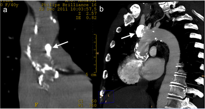 Figure 4a–b.