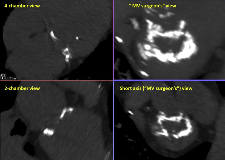 Figure 2