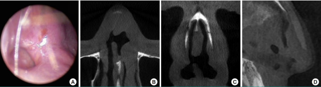 Fig. 12.