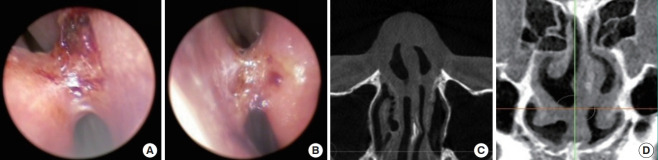 Fig. 11.