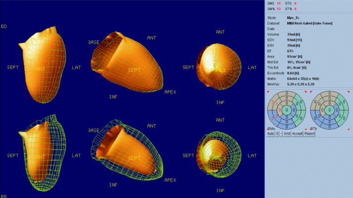 Fig 3 –