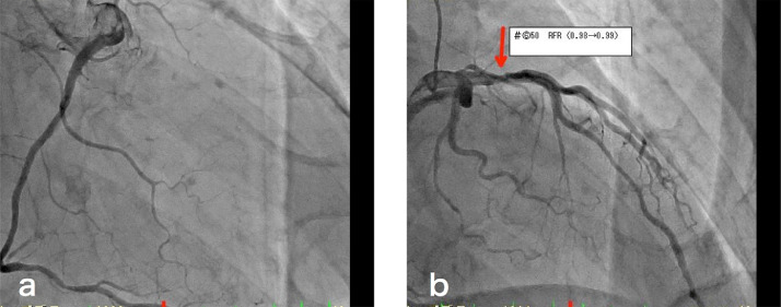 Fig 2 –