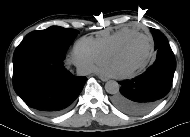 Fig 5 –