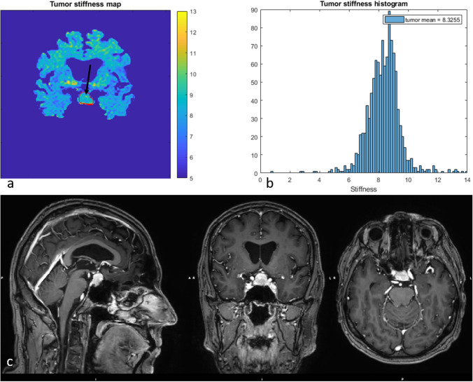 Fig. 4