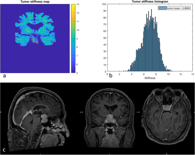 Fig. 3