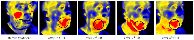 Fig.3