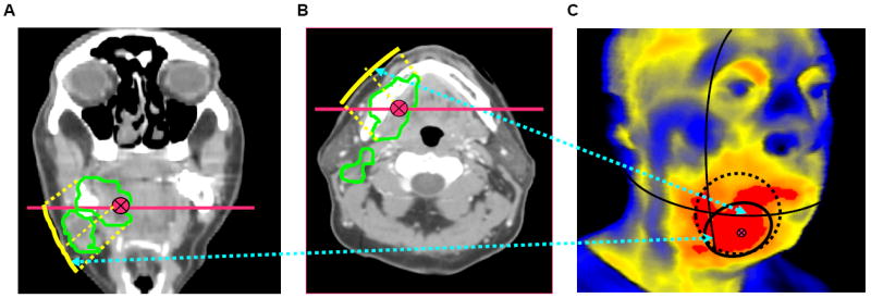 Fig.4