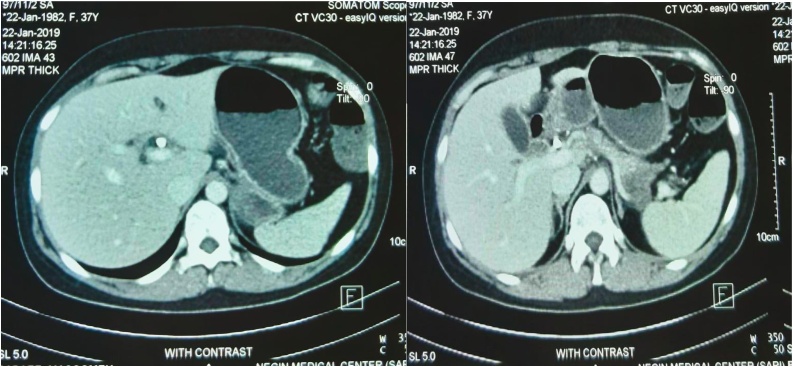Fig. 2