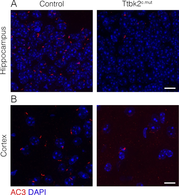 Figure 5—figure supplement 1.