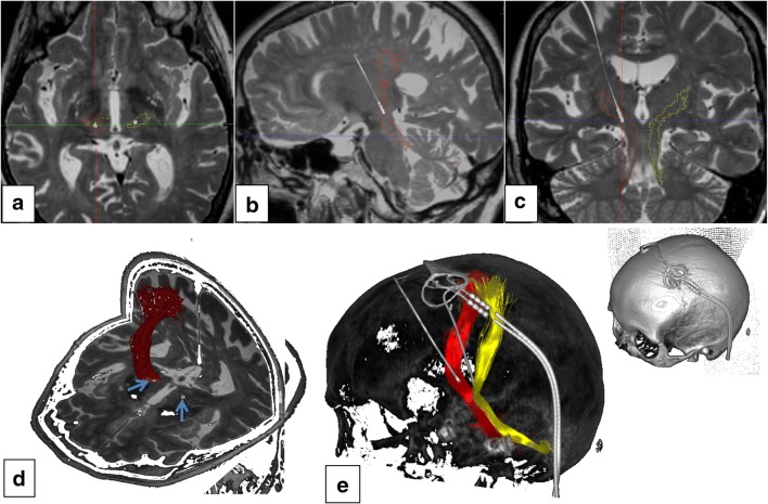 Fig. 1