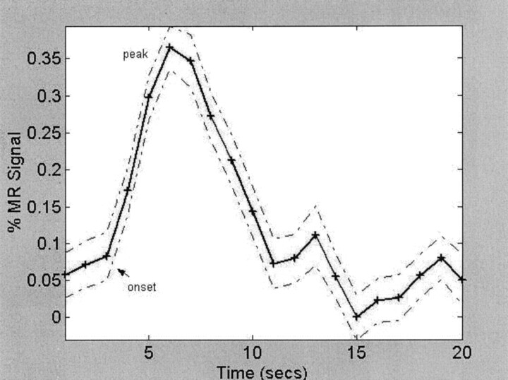 Fig 2.