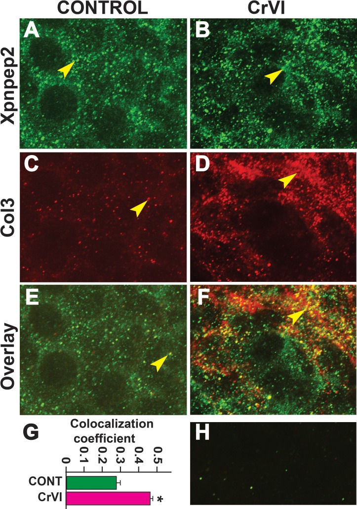 FIG. 11