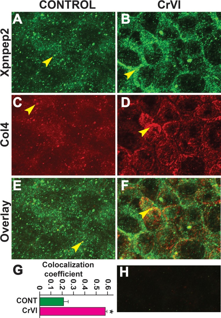 FIG. 12