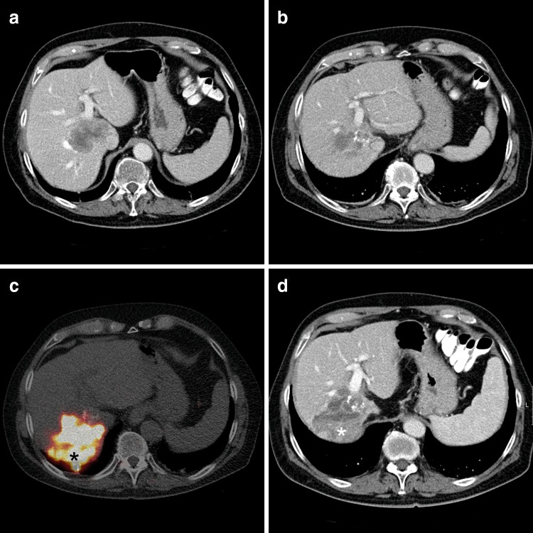 Fig. 1