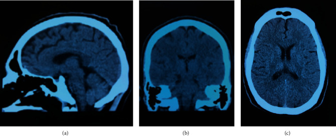 Figure 2