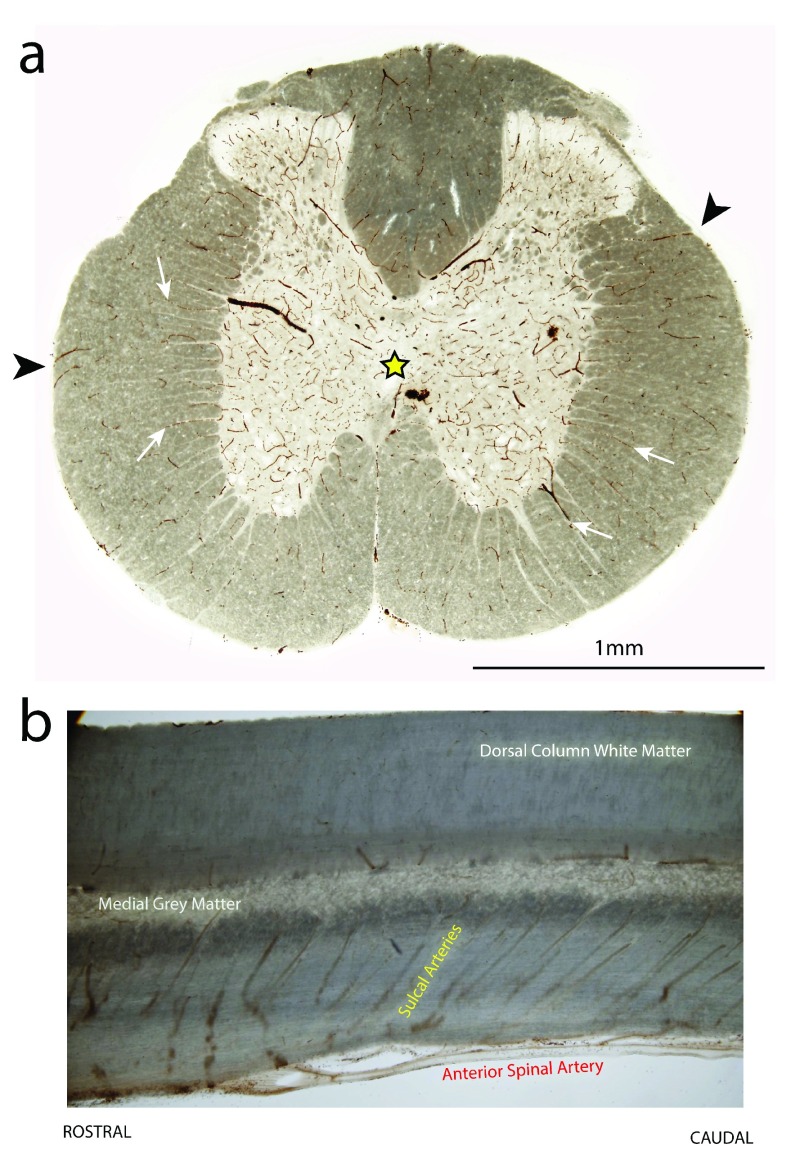 Figure 11. 