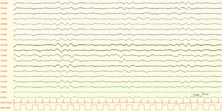 Fig. 1