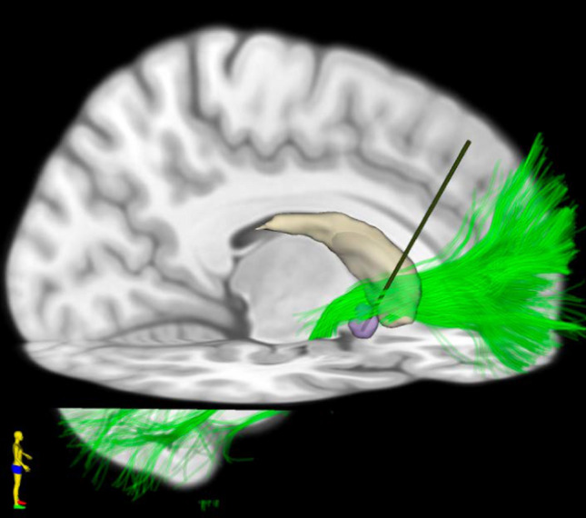 Fig. 2