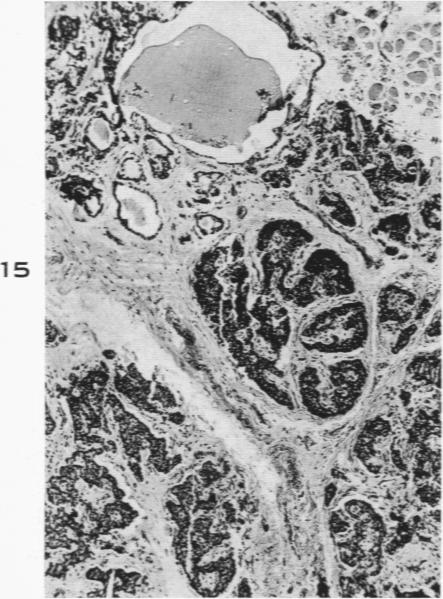 Fig. 15