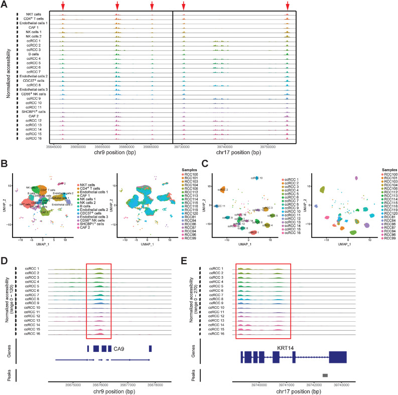 Figure 5. Single-cell chromatin accessibility characteristics in ccRCC. A, Chromatin accessibility profiles of each cluster in chr 9 and chr 17. B, UMAP of non-tumor cells identifies cell clusters (left) and sample origin (right). C, UMAP of tumor cells identifies cell clusters (left) and sample origin (right). D and E, Specific chromatin accessibility region of tumor cells identified by scATAC-seq.